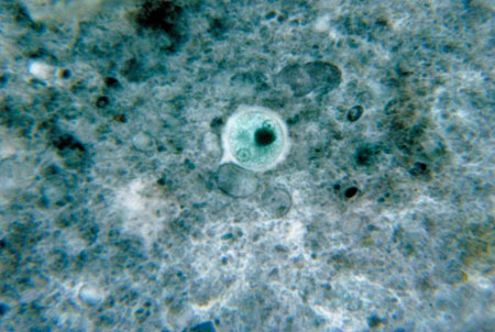 Đơn bào Entamoeba histolytica.